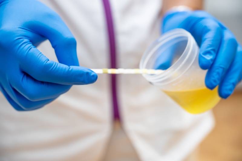 Urine foncée fautil s’inquiéter ? Quelles en sont les causes