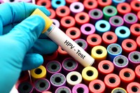 hpv-homme