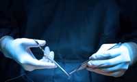 vasectomie-reversible-vasclip