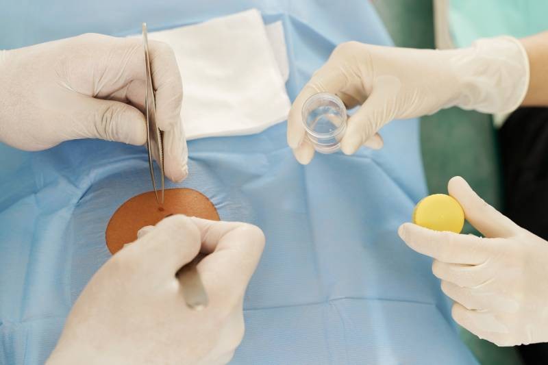 Biopsie : indications, techniques et interprétations des résultats ...