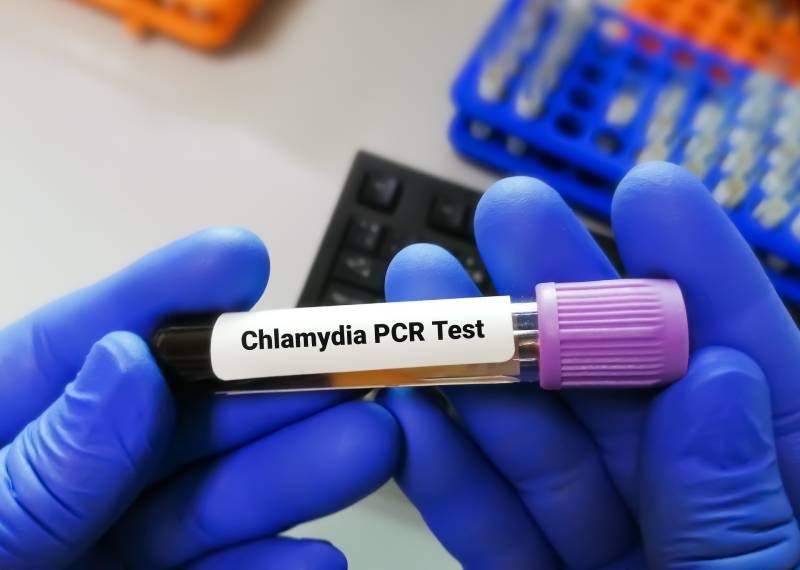 Chlamydia traitement : durée, ordonnance et efficacité | Charles.co