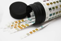 test-urinaire-laboratoire