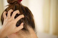 cheveux-psoriasis-cuir-chevelu