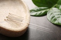acupuncture-magnetique-pour-maigrir-avis