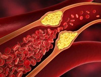 cholesterol-total-superieur-a-2