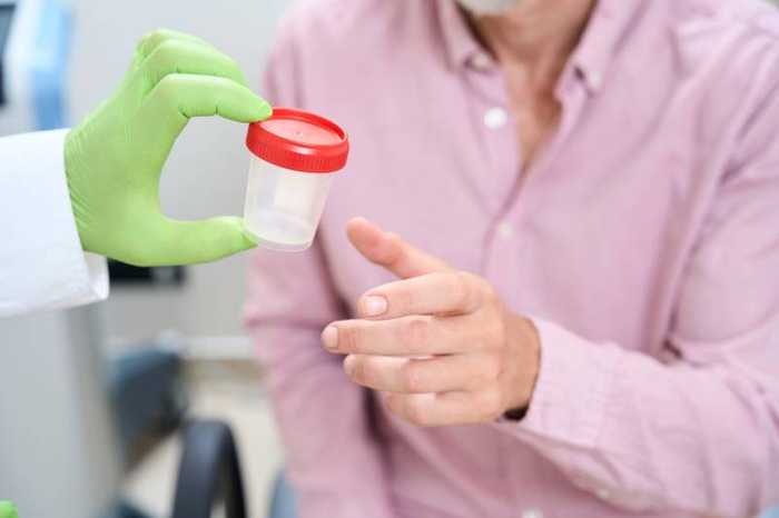 Créatinine urinaire : taux normal et causes d’un taux trop haut