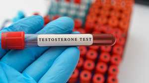 Quels sont les taux normaux de testostérone chez l’homme ?