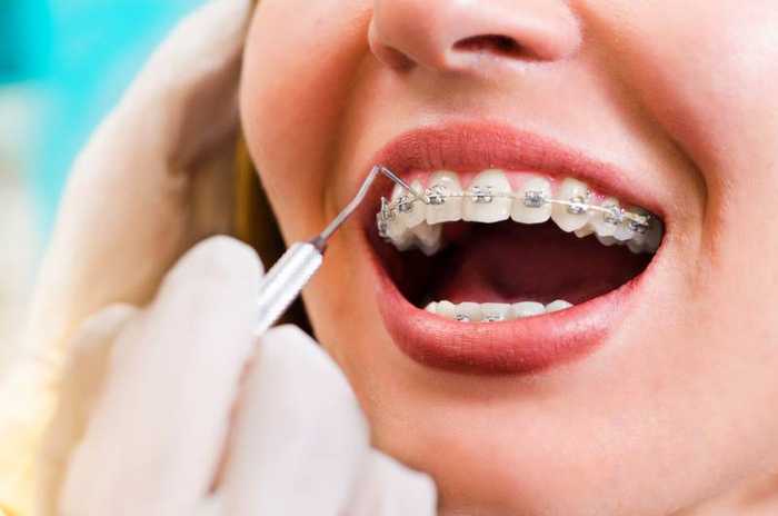 Orthodontie : solutions, prix et remboursement