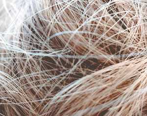 Cheveux clairsemés chez la femme : causes et traitements