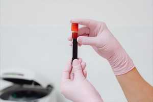 À quelle fréquence réaliser un bilan sanguin VIH ?