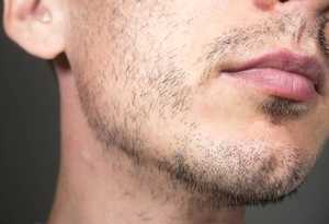 Minoxidil barbe : résultats, accessibilité et prix