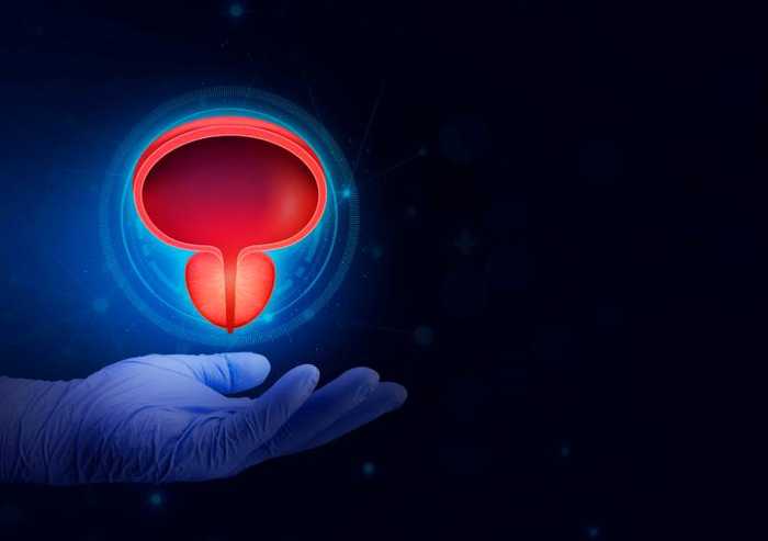 Comment vider la prostate ?