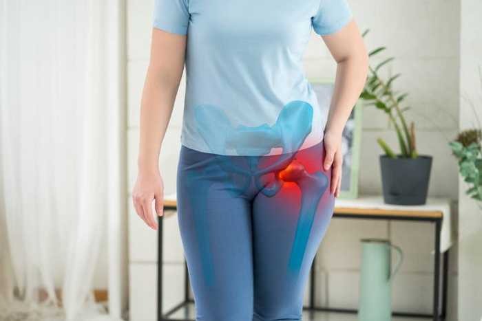 Arthrose hanche : symptômes, traitements et durée d’une crise