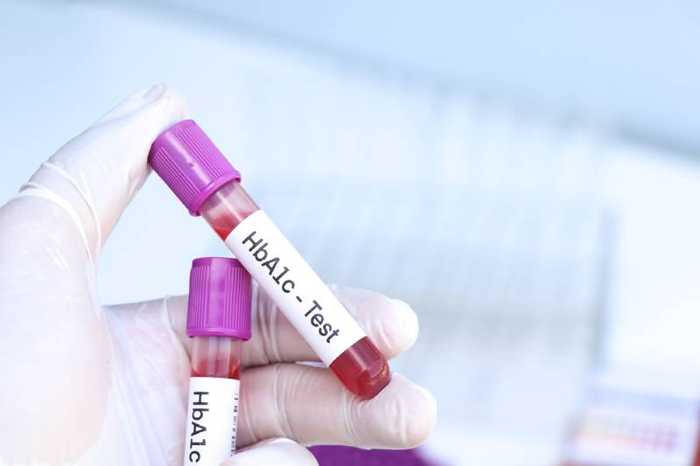 Hémoglobine glyquée : définition, valeur normale ou trop élevée