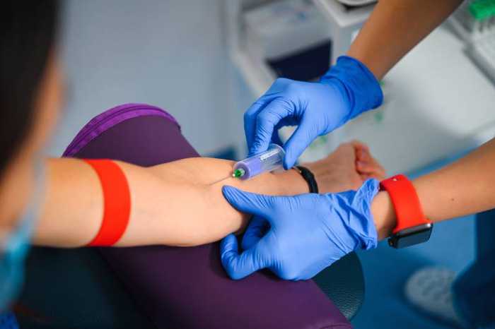 Vitesse de sédimentation : valeur normale et causes d’une valeur élevée ou basse