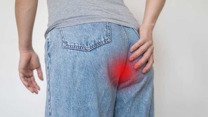 Irritation anus : causes et traitements