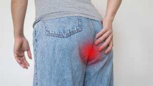Irritation anus : causes et traitements
