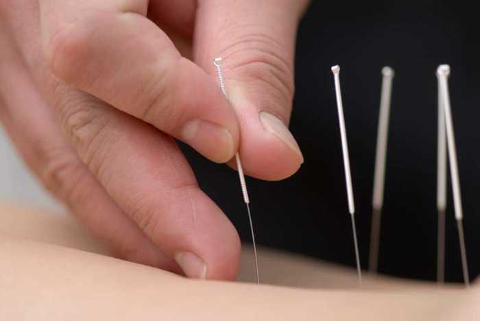 Acupuncture pour maigrir : avis, ménopause, point sur le pied